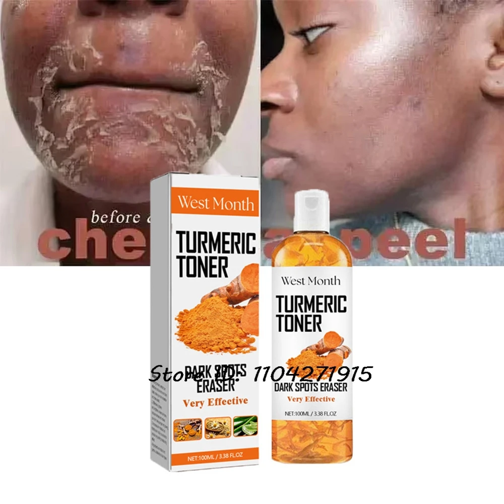 Turmeric Toner Dark Spots Eraser Whitening Face Turmeric Oil Fade Dark Spot Brighten Removal Pigment Essence 100ml