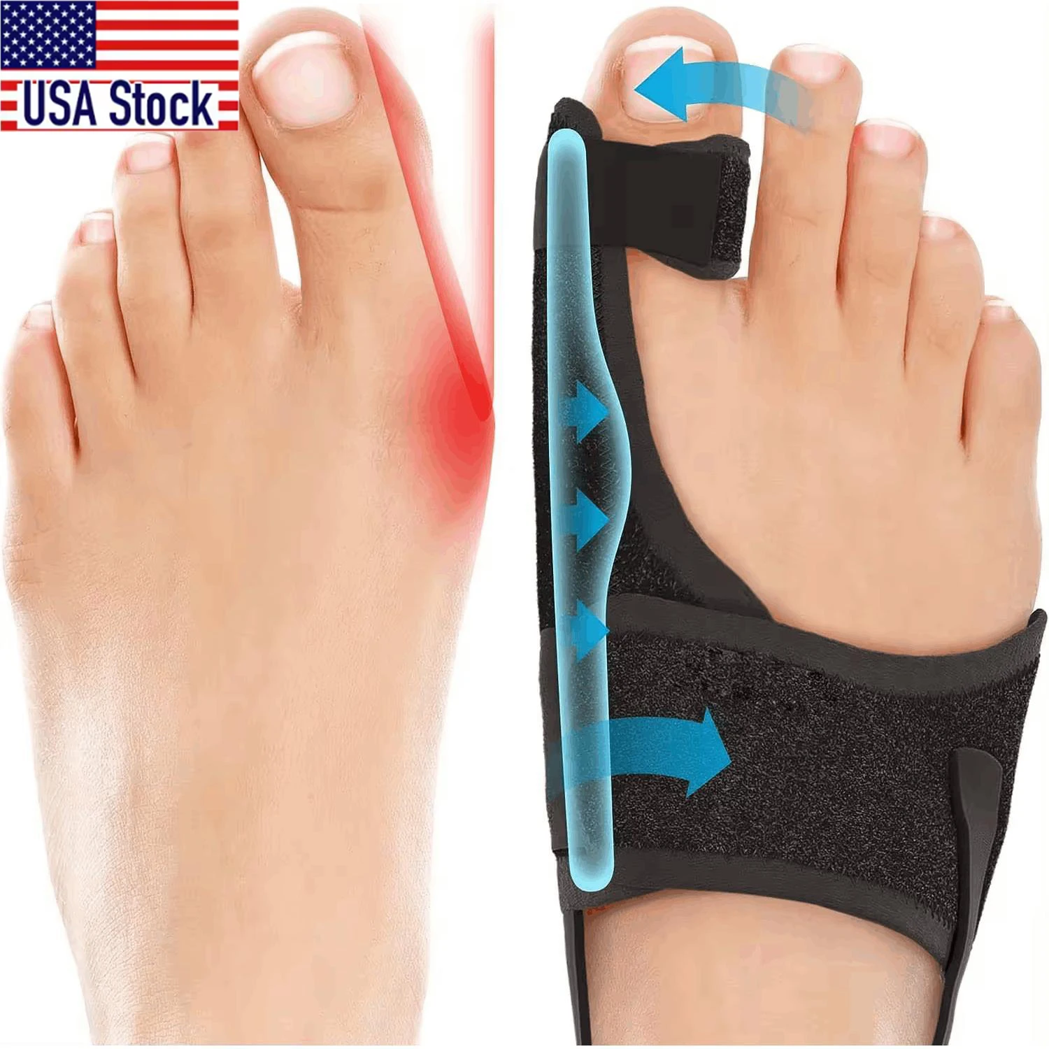 زوج واحد من أجهزة تصحيح أصابع القدم الكبيرة للنساء والرجال الذين يعانون من مرض الحوض التهاب