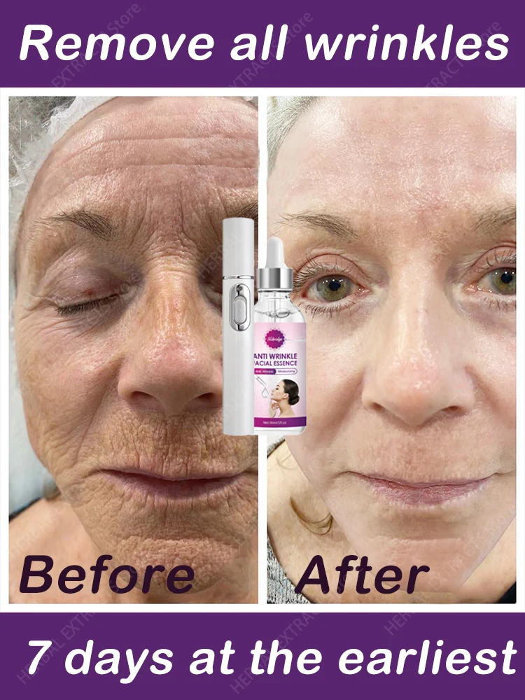 Solve all facial wrinkle problems