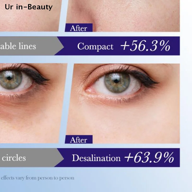 

20g SADOER Evening Primrose Eye Cream Anti Dark Circles Eyes Bags Remover Anti-aging Moisturizing Eyes Skin Care Cosmetics