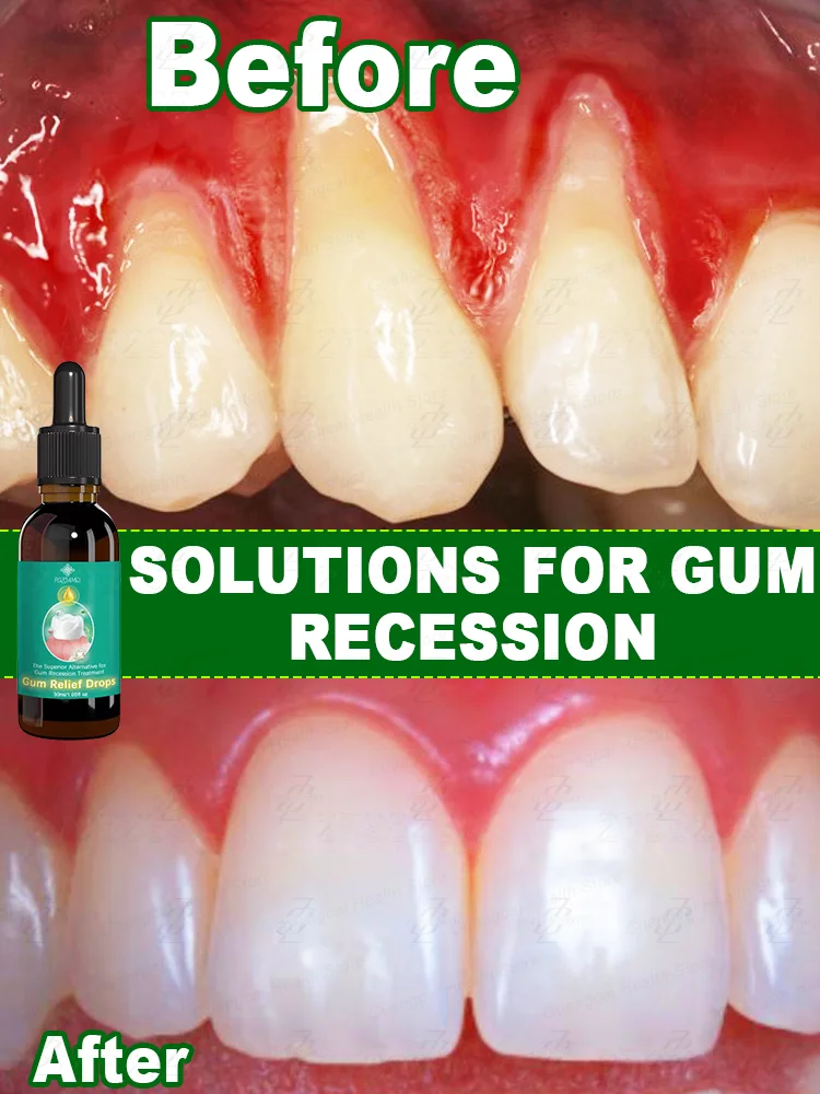 

Rᴇᴘᴀɪʀ ᴅᴀᴍᴀɢᴇᴅ ɢᴜᴍs, ʀᴇʟɪᴇᴠᴇ ɢᴜᴍ ᴘᴀɪɴ, sᴛʀᴇɴɢᴛʜᴇɴ ɢᴜᴍs, ʀᴇsᴛᴏʀᴇ ʜᴇᴀʟᴛʜʏ