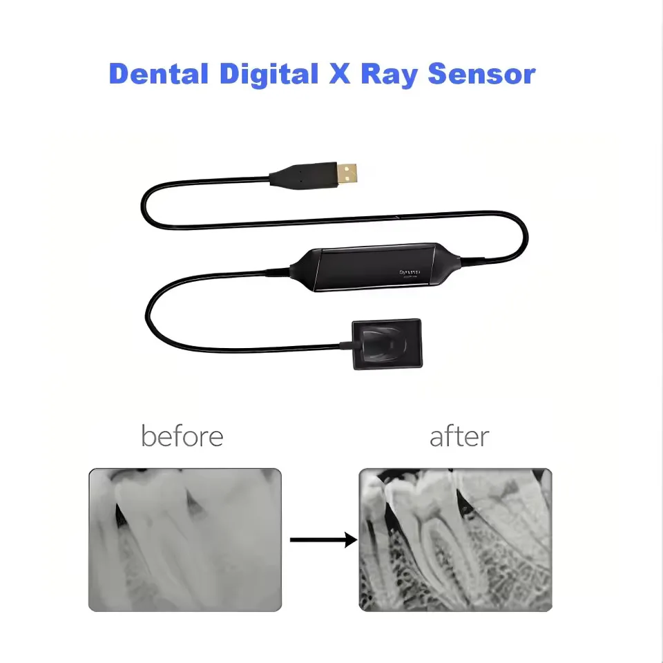 Runyes DR730 Digital Intraoral X-Ray Sensor Intraoral Dental Imaging System Oral Dental Equipment for Dental Clinic