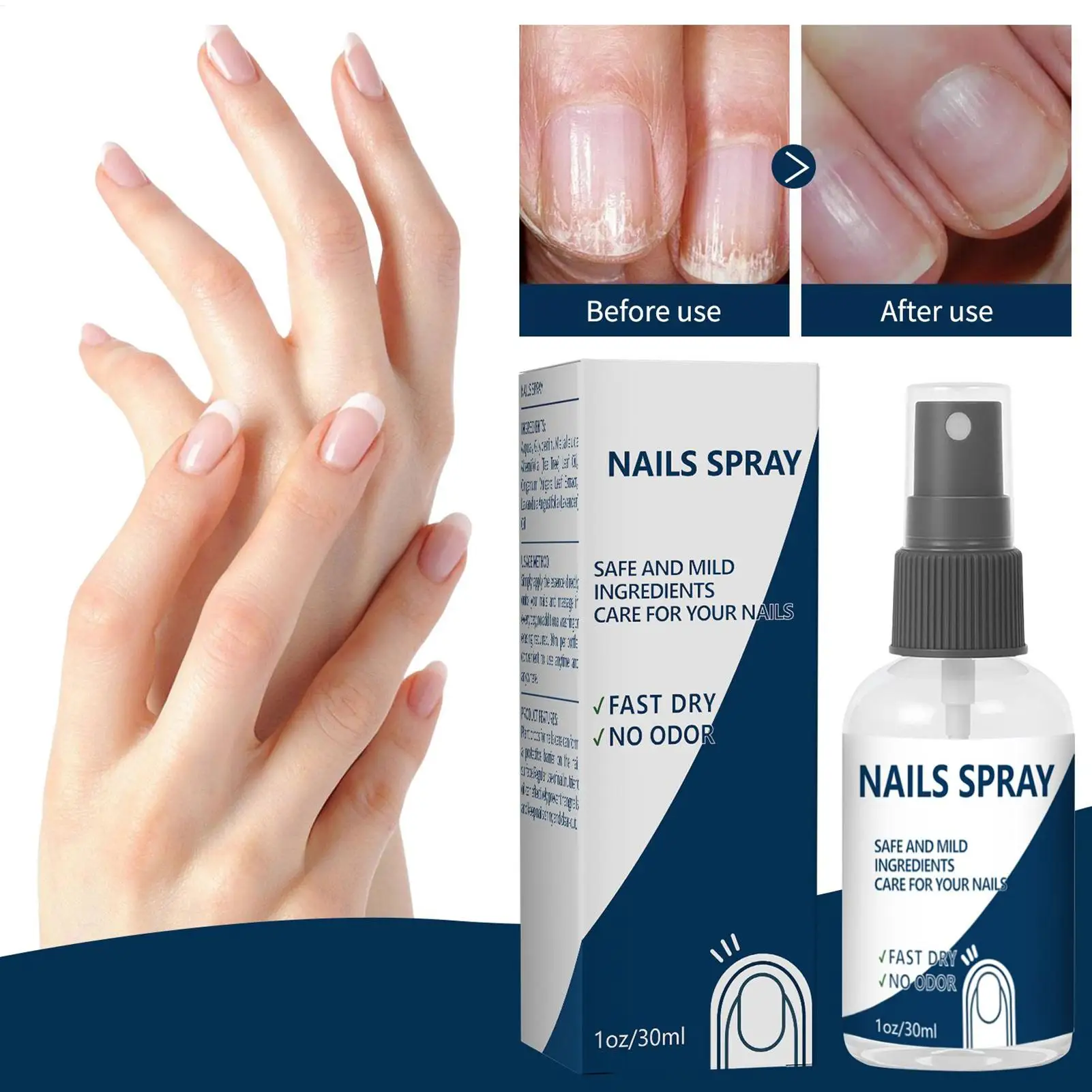 Nail Strengthener Spray - Long-Lasting Renewal Solution for Fingernails & Toenails Care - Nail Nutrition for Women, Girls