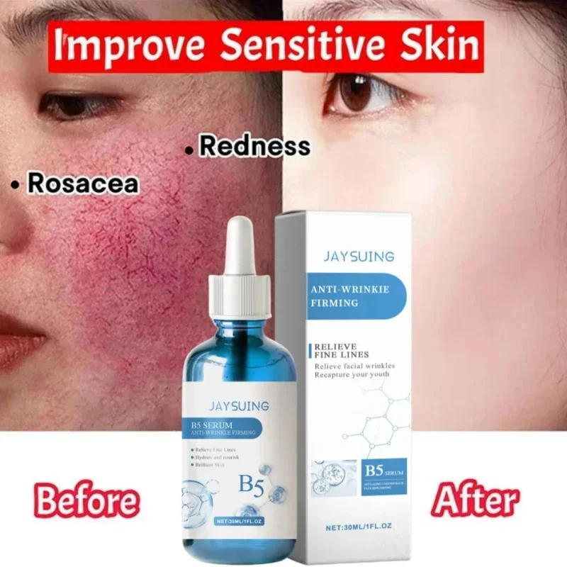 

Repair Facial Redness Serum Instant Spider Vein Remove Sensitive Skin Sooth Anti Redness Rosacea Treat Lotion Korean Cosmetics