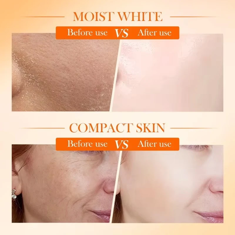 Vitamin C Face Cream Evens Skin Tone, Eliminates Dark Spots & Dullness, Whitening And Moisturizing Cream, For Day And Night Use
