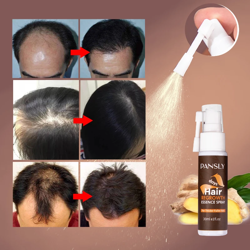 

Ginger Hair Growth Spray Essential Oils Prevents Hair Loss for All Hair Types Fast Treatment Prevent Hair Thinning Dry Repair