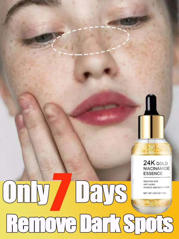 24K Goud Niacinamide Serum Donkere Vlek Remover Hyaluronzuur Voor Gezicht Serum Hydraterende Fleuren Gladmakende Gezichtsverzorging