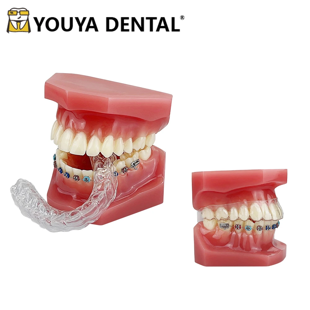 

Orthodontic Dental Teaching Study Model Invisible Orthodontic Tooth Model for Dentist Student Dental Clinics Demonstration Tools