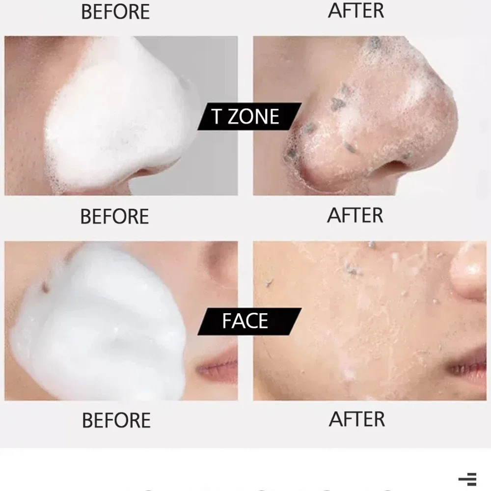 フェアキング角質除去ムース肌の質感を改善メイクアップダストを洗浄拡大した毛穴を改善油を吸収化粧品卸売