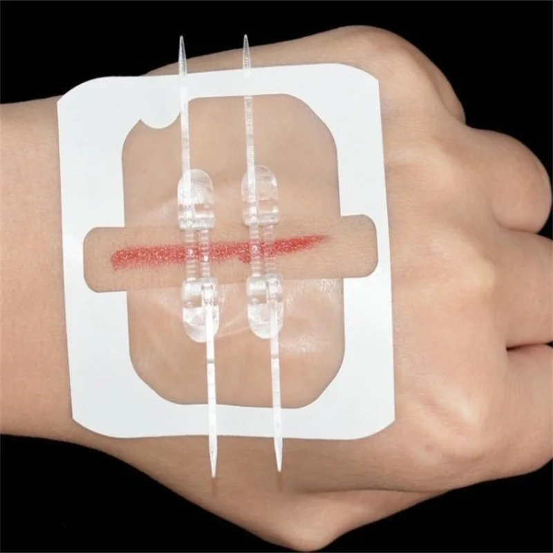 2Pcs Zipper Tie Wound Closure Patch Zipper Band-Aid Wound Fast Suture Outdoor Portable Hemostatic Patch