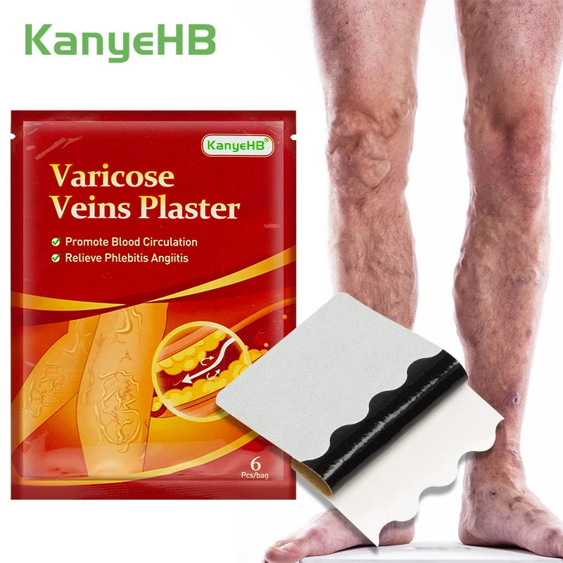 

6Pcs=1Bag Varicose Veins Plaster Chinese Medical Patch Vasculitis Phlebitis Veins Pain Leg Skin Care Angiitis Removal Patch W006