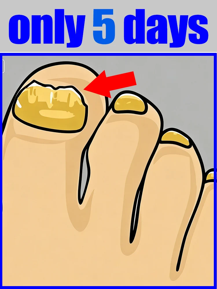 

Spring Festiva HOT SALE Technology changes lives,Rejuvenator - Fungus Prevention Technology - Adjustable Control & Safety Sensor