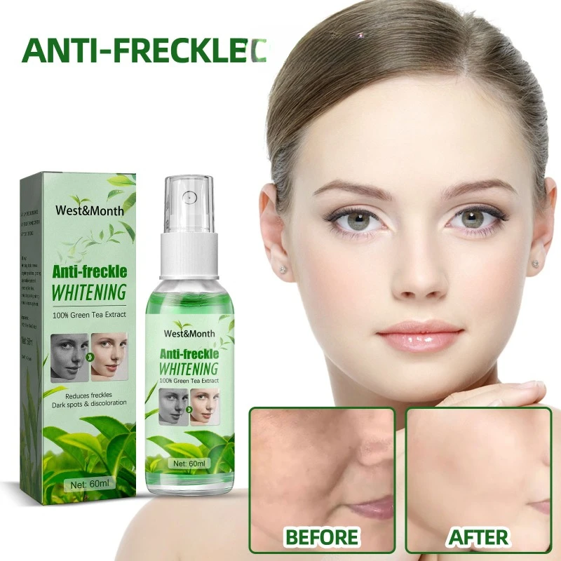 O pulverizador facial do cuidado do chá verde, reduz pontos escuros, pigmento, maçante ilumina, clareamento, sarda, antienvelhecimento, beleza da pele, água