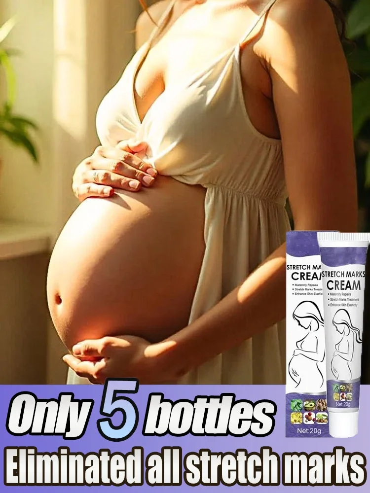 

Scar Stretch Marks Cream Repair cream Removal Acne Scar Stretch Marks Cream Fat Scar Striae Treatment Body Creams