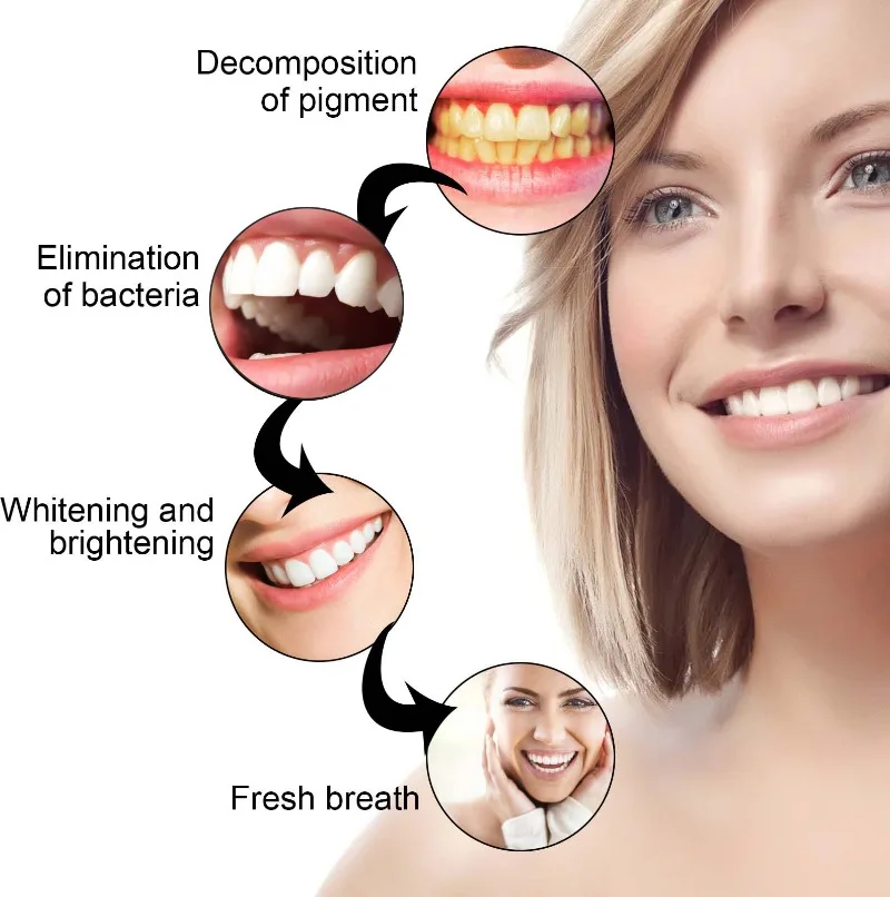 معجون تبييض الأسنان ، مزيل حساب التفاضل والتكامل للأسنان ، مزيل البلاك ، تفتيح التنفس الطازج ، منع التهاب اللثة ، العناية بالأسنان