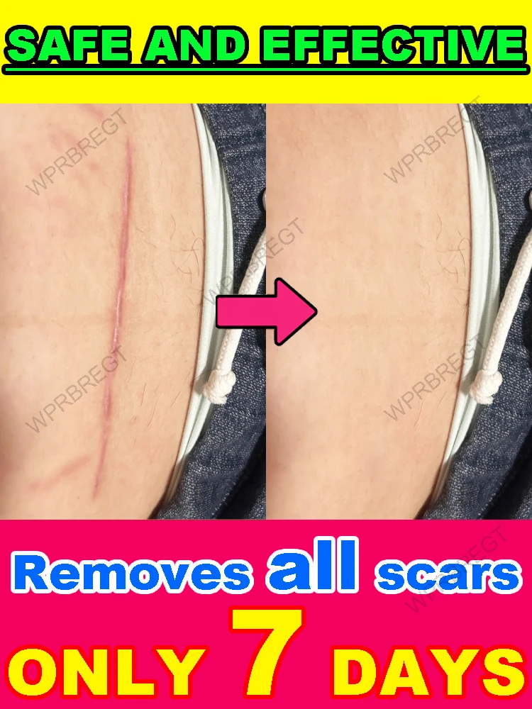 Transformação da pele sem deixar vestígios!! !