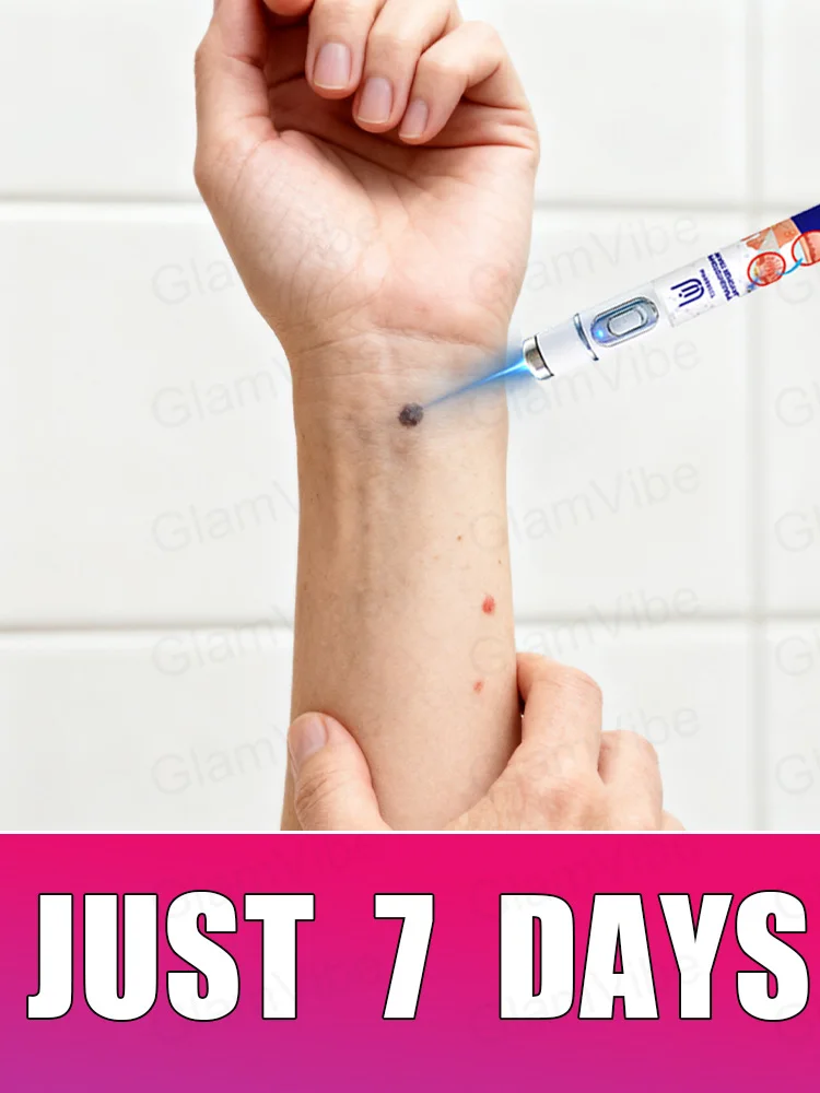 

2nd ᵍᵉⁿᵉʳᵃᵗⁱᵒⁿ ᵘᵖᵍʳᵃᵈᵉᵈ wᵃʳᵗ ⸴ ʳᵉpᵃⁱʳ wᵃʳᵗˢ ʳᵒoᵗ ⸴ ᑫᵘⁱᶜᵏˡʸ