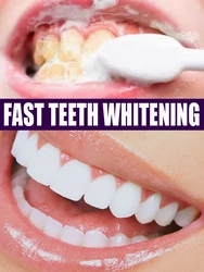 Mousse Toothpaste Teeth Whitening Removing Yellow Teeth Cleaning Tooth Stain Oral Fresh Tooth Care Product