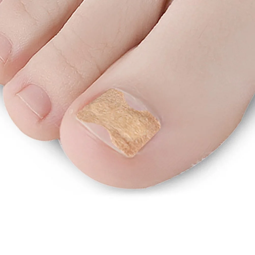 

1Set Toenail Patch Correction Buckle Kit Invisible Anti-Grinding Paste Dead Skin Cone Nail Clasp Nail Tape Ingrown Toenail