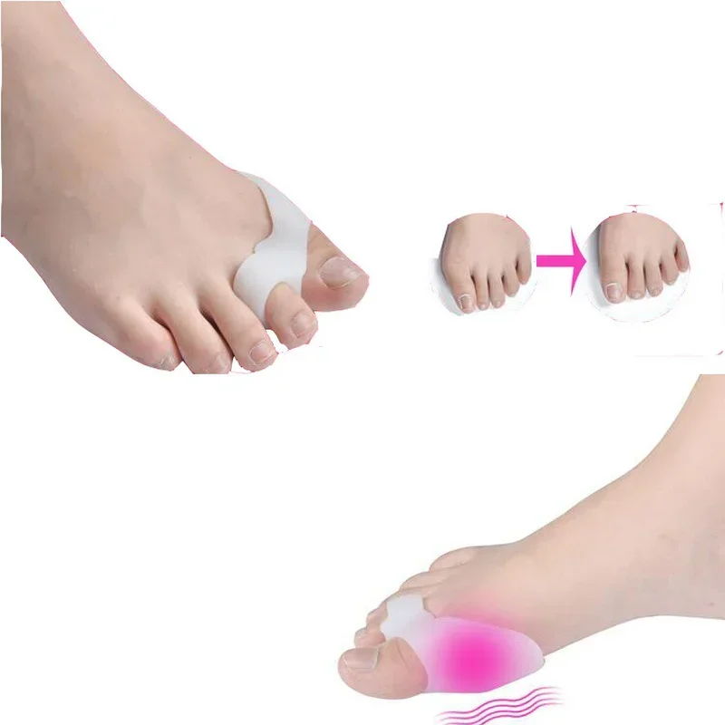 Doigts de pied en gel de silicone, protecteur de pouce Valgus, ajusteur d'oignon, garde Hallux Valgus, soins des pieds, séparateur Parker à deux trous, 1 paire