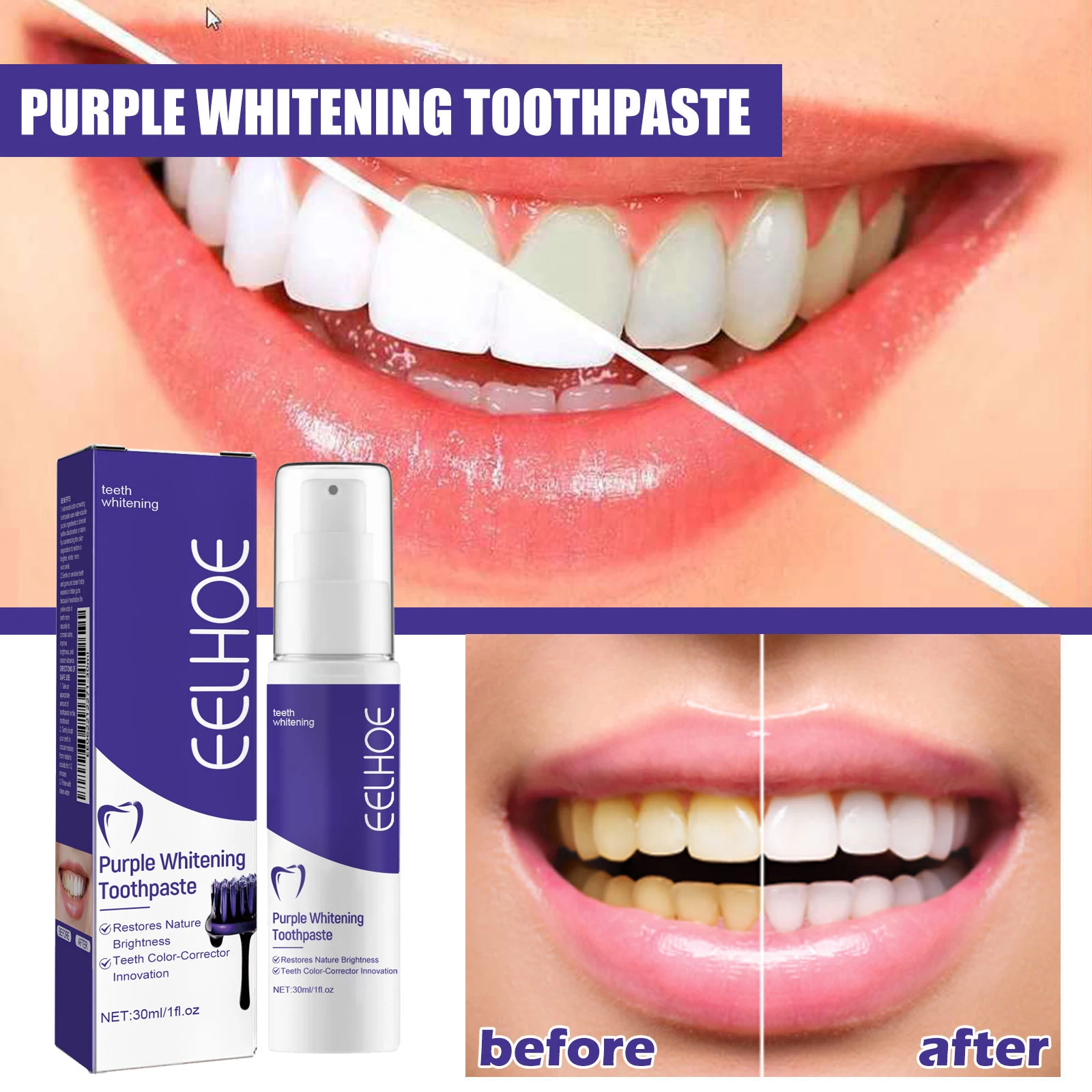 Tandenreiniging Whitening Tand - Teeth Whitening Korea recensie en prijs
