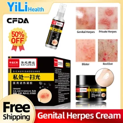 Genital Herpes Treatment Medical Spray Herpes Simplex Cure for Men and Women Shingles Medicine Cream CFDA  Approval 50ml/bottle