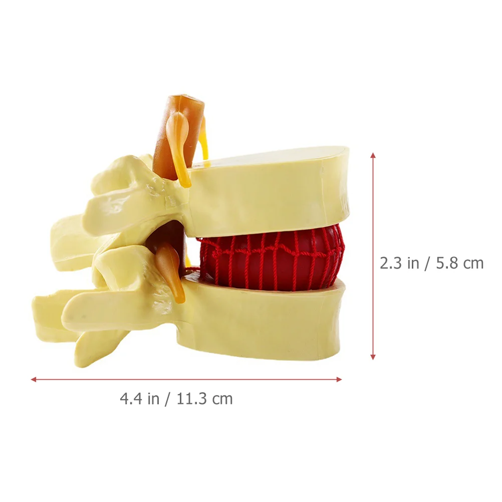 Spine Anatomical Model Intervertebral Disc Models Human Lumbar Herniation White