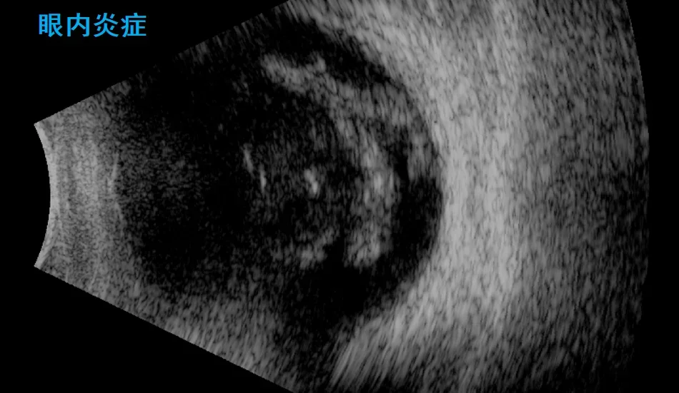 2025 Ophthalmic Scanner SK-3000A Ophthalmology Machine with AB Scan Ocular Ultrasound Instrument