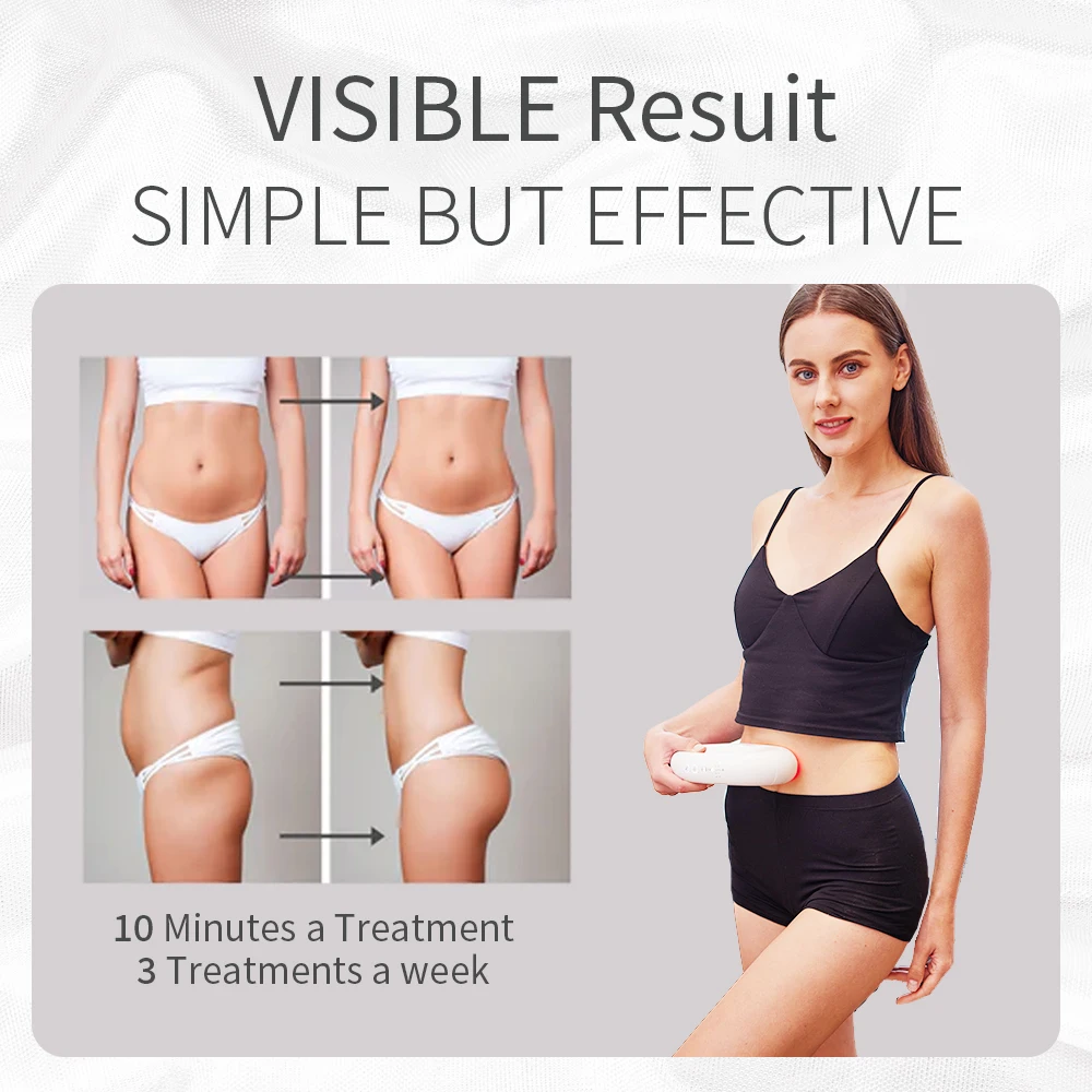 rf body slimming device body shaping cellulite slimming fat burning stretch mark removal smooth shapes cellulite machine