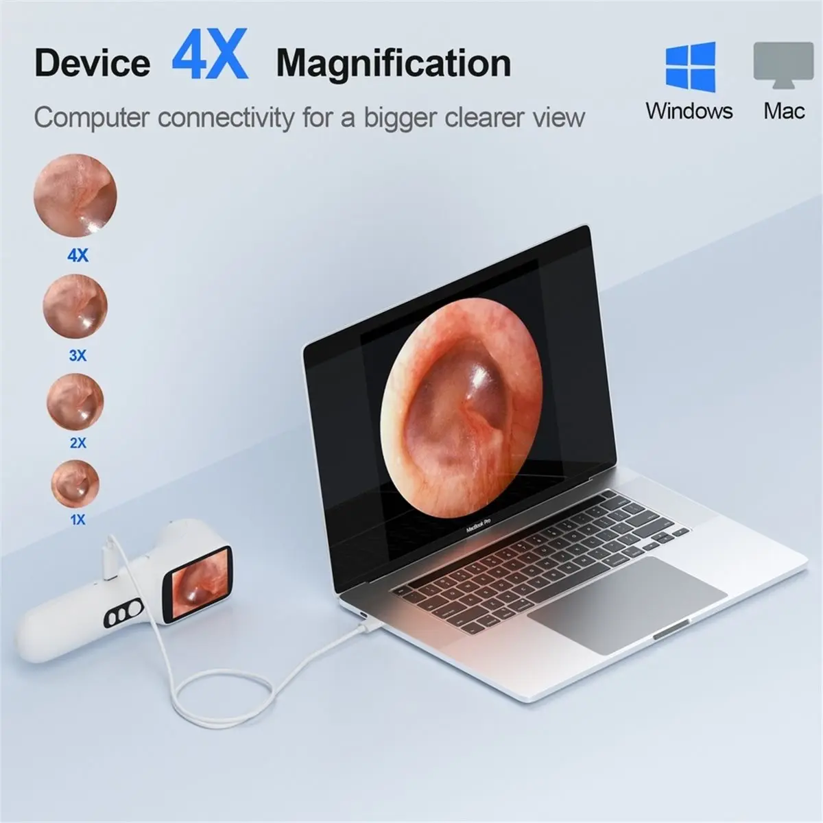 【a43i】ipsスクリーン搭載デジタル耳鏡、720p-hdスマートビジュアル耳カメラ、耳鏡カメラ、耳垢除去ツールカメラ