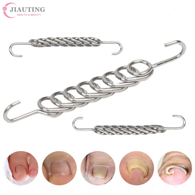 คุด Toenail Corrector เครื่องมือ Pedicure Recover ฝัง Toe Nail Treatment Professional คุด Toenail Correction เท้า CareTool