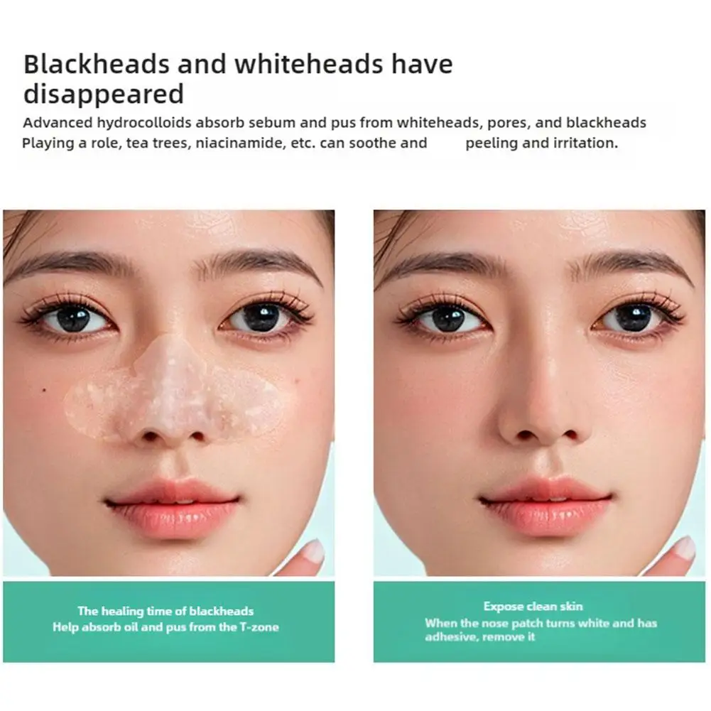 Hydrocolloid แถบจมูกสําหรับควบคุมน้ํามันสาวเกาหลี Blackhead Removal Whitening Nose Mask Skin Care แถบทําความสะอาดรูขุมขนจมูก