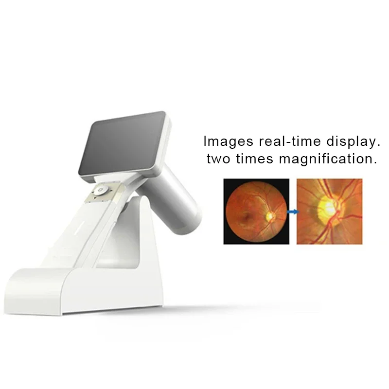 Hd Oogheelkundige Instrument Digitale Draagbare Hand-Held Fundus Apparatuur Handheld Hfc-1 Volledige Prijs