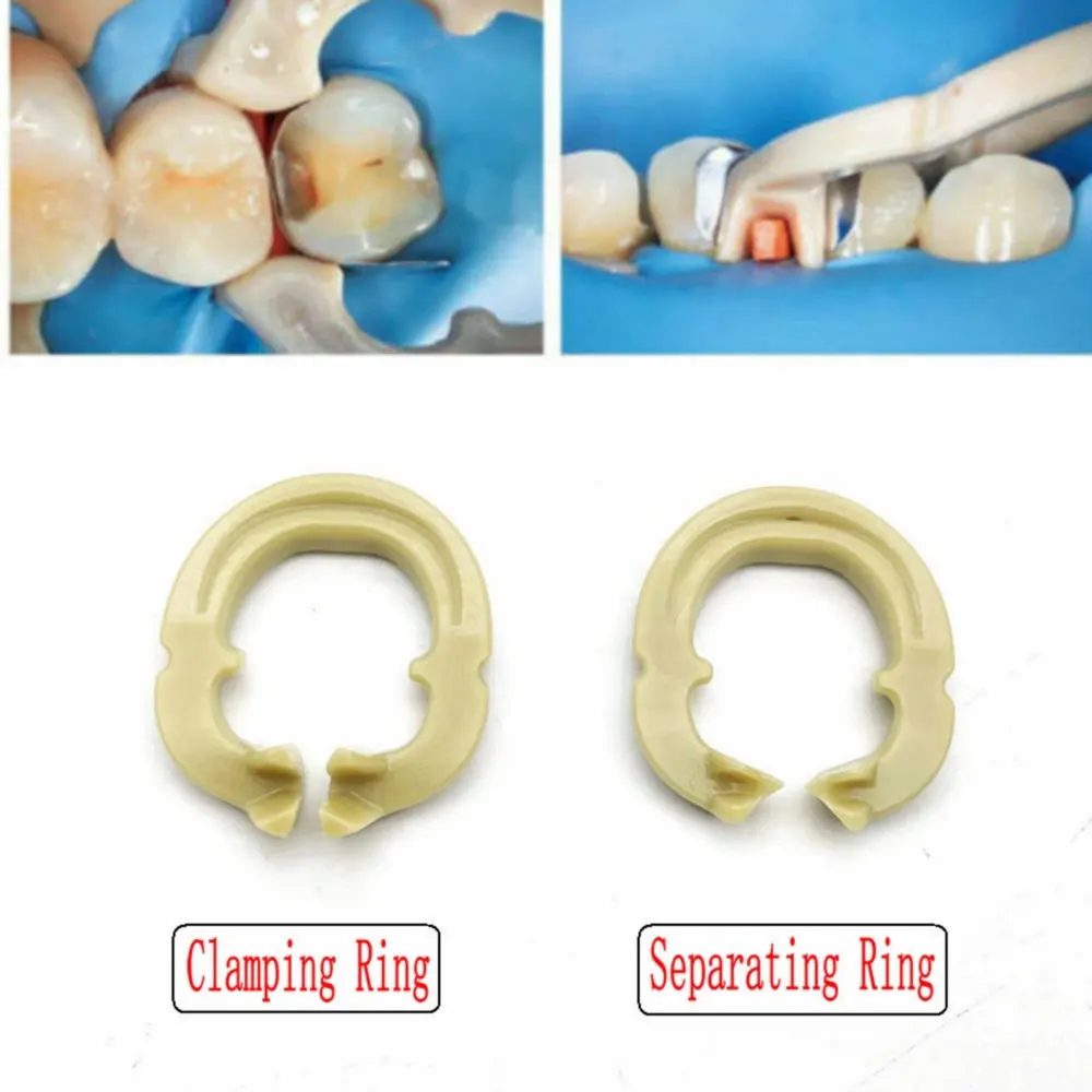 2pcs/box Dental Resin Clamping/Separating Ring Dentist Tools Autoclavable Tools for Dental Lab Instrument