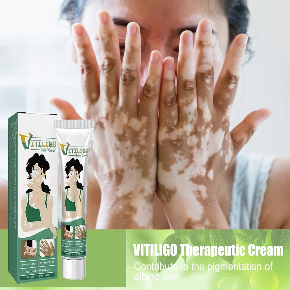 

Reduce White Spots Skin care Removal Skin Vitiligo Remove Ringworm White Spot