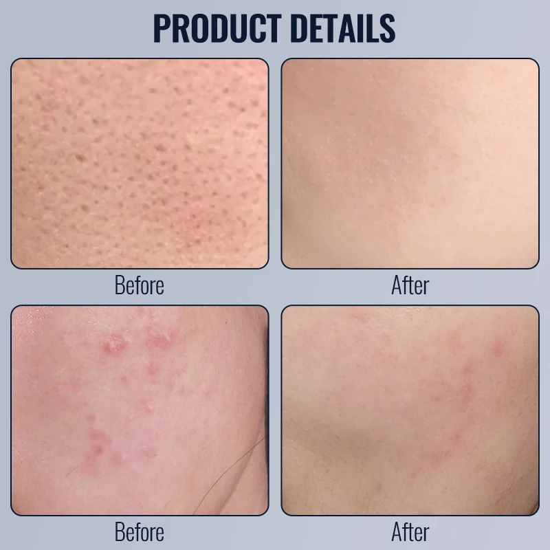 2025 جهاز شد الوجه مكركرنت مكافحة الشيخوخة إزالة التجاعيد EMS الكولاجين رفع تجديد الجلد العلاج بالضوء الأزرق