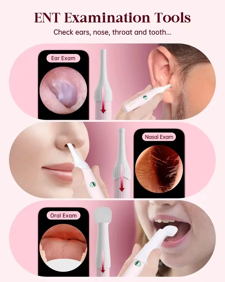الأصلي Bebird EarSight Pro I35R اللون الوردي الكل في 1 الأذن قضيب شمع الأذن إزالة أطقم البصرية الأذن الأنظف انحناء وبأسعار معقولة