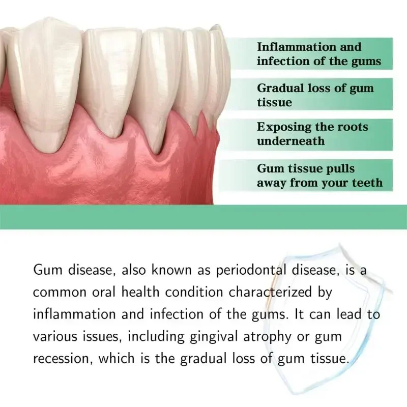 Quickly Repair Gum Serum Care Teeth Whiten Remove Yellow Repair Gum Regrowth Plaque Stains Relieve Gums Decay Toothache