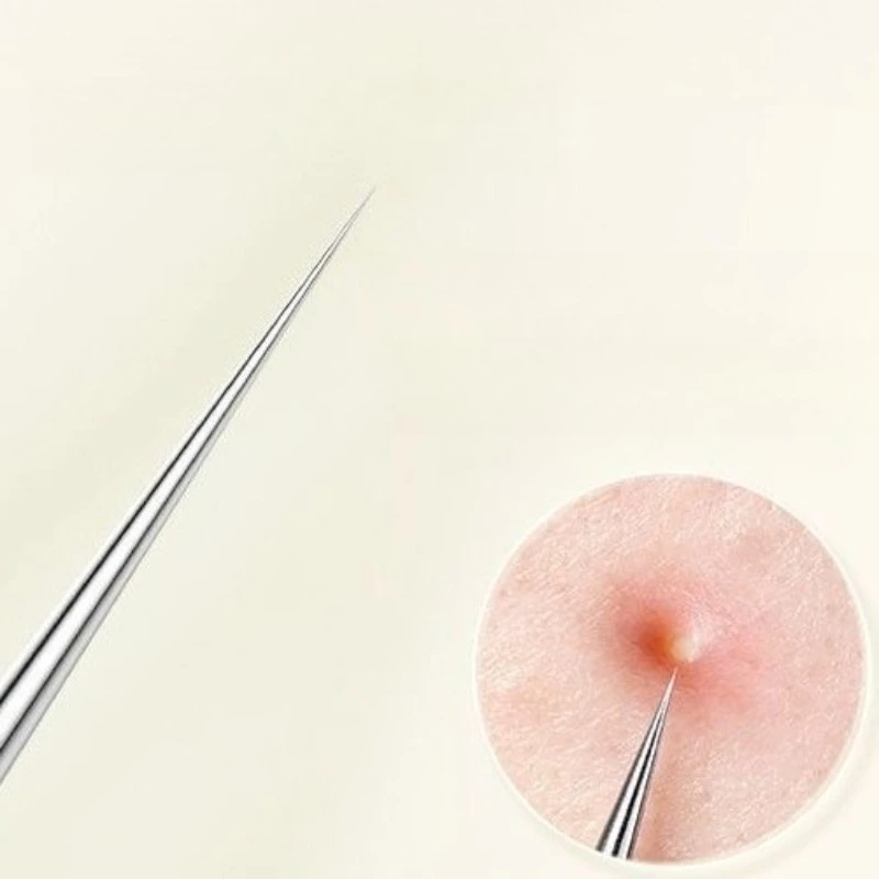 1/2 pz Doppio Anello di Rimozione di Comedone Popper Acne Comedone Blemish Brufolo Estrattore In Acciaio Inox di Rimozione di Comedone Viso pulito