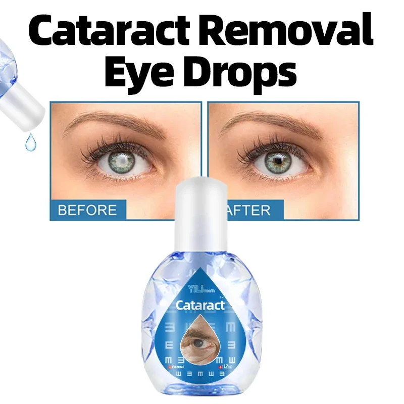 

Cataract Treatment Medicine 12Ml Improve Eye Discomfort Blurred Vision Macular Degeneration Presbyopia Removal Eyes Drops