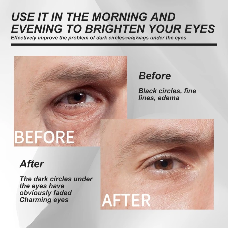 Men's Eye Cream Repair Eye Bags Dark Circles remove Fine lines Fade Wrinkles Anti aging Moisturizing brighten Firming Eye care