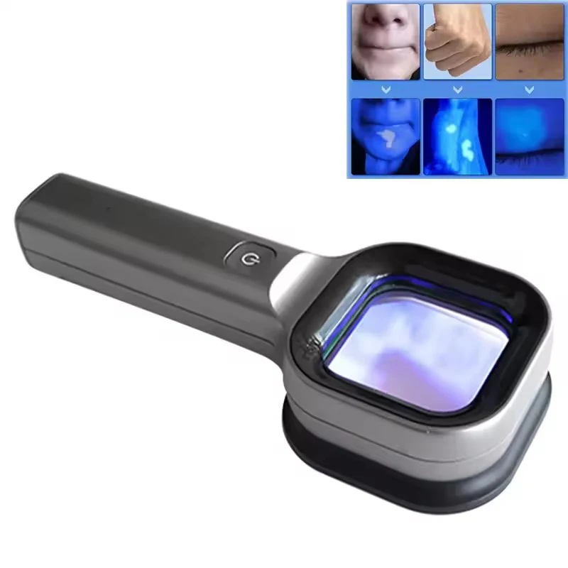 Woods Lamp Skin Analyzer Skin UV Magnifying Skin Testing Home Use Facial Testing Wood Light Face Analysis Detection Beauty Care
