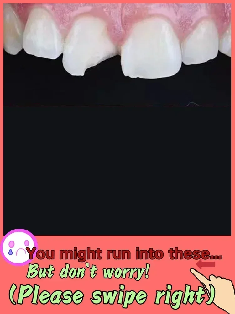 3R إصلاح سريع للتسوس إزالة البقع البلاكية تسوس تبييض اصفرار إصلاح تبييض الأسنان #4