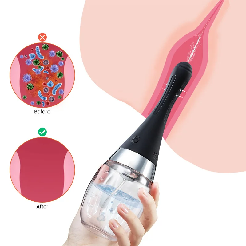 Limpiador eléctrico de tapón Anal para hombres y mujeres, Enema Rectal de salud, ducha, enemador de Vagina, artículos íntimos, juguete sexual Anal, herramienta de enjuague