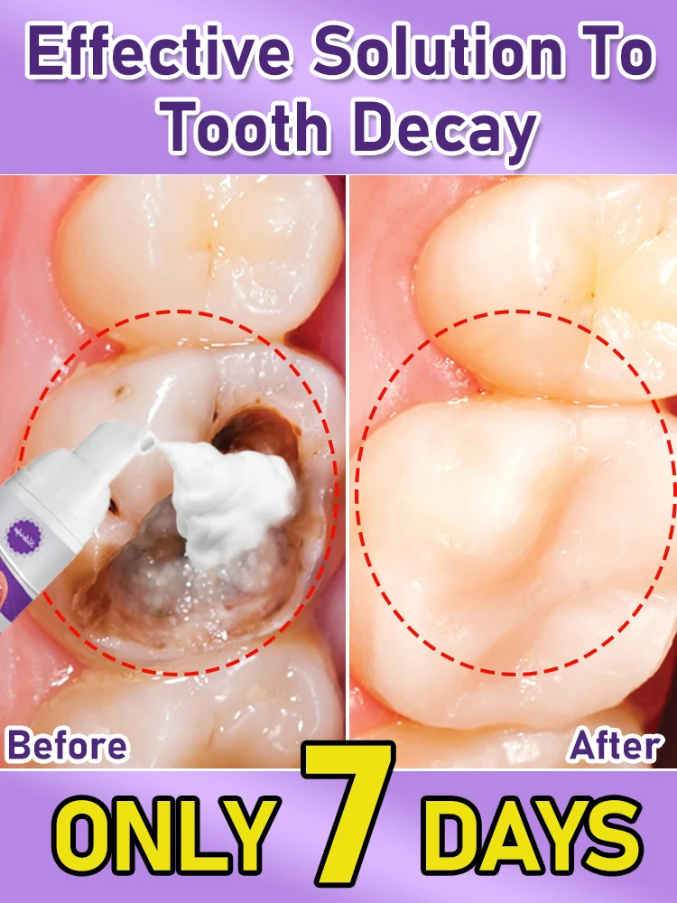 

teeth cleaning products