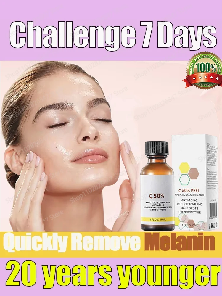 

Peeling Serum Bleaching Dark Skin Spots Remove Dead Skin Melanin Scrub Exfoliating Whiten Moisturize Skin Rejuvenating Essence