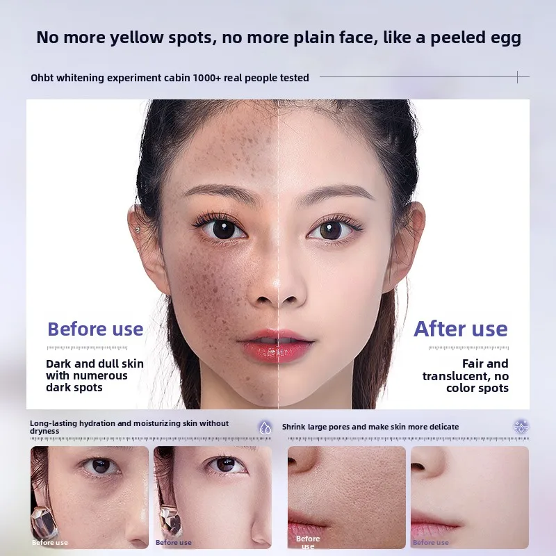 كريم ترطيب تبييض بيربيري 50 جرام، كريم النياسيناميد المضاد للبقع، ترطيب وتقليل التجاعيد #4