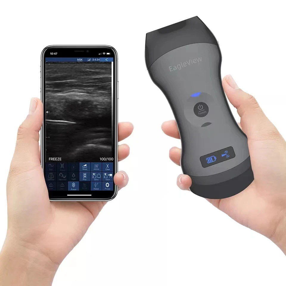 

Rehabilitation Physiotherapy Doppler Wireless Handheld Ultrasound Vascular USB Scanner Double Linear for Full-body Diagnostic