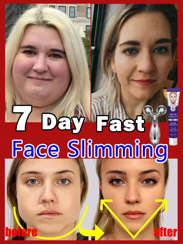 

Fat removal for double chin and V-shaped face