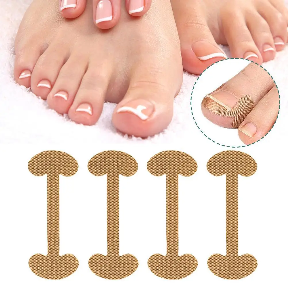 

Ingrown Paronychia Toenail Corrector Strips Anti Nail Patch Feet Sleeping Nail Patch Nails into the Flesh Long 48pcs=(12 sets)